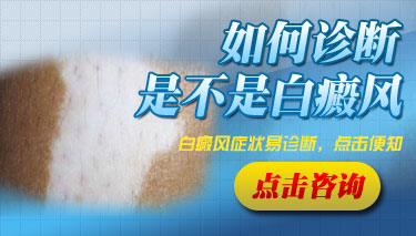 白癜风诊断的方法