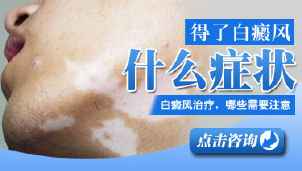 白癜风患者的常见症状表现有什么